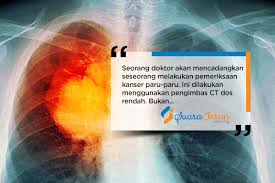 Ia adalah kanser yang paling banyak dihidapi sekarang. Apa Yang Perlu Diketahui Mengenai Kanser Paru Paru