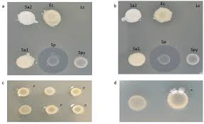 Image result for Neisseriaceae