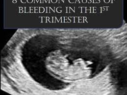 Try a warm bath or a heating pad. 8 Common Causes For Bleeding In The First Trimester Wehavekids