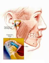 Pin On Tmj Really Hurts