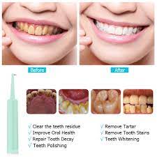 We did not find results for: Amazon Com Plaque Remover For Teeth Cleaning Kit Alitake Ultrasonic Tooth Cleaner Electric Dental Calculus Remover With Oral Mirror Led Light And Replaceable Cleaning Heads Blue Health Personal Care