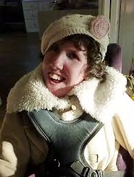 Doctors said Emily Weaver wouldn't live more than a few days but she's just  celebrated her 30th birthday