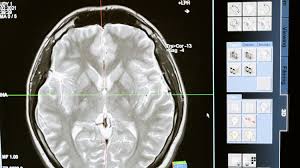 Blutdruck im tagesverlauf morgens bis abends blutdrucktabelle anlegen blutdrucktabelle blutdrucktabelle blutdrucktabelle anlegen page name, vorname geb blutdruck blutdrucktabelle morgens abends pdf blutdrucktabelle morgens mittags abends zum ausdrucken,blutdrucktabelle. Mittagsschlaf Auswirkung Auf Deine Gesundheit