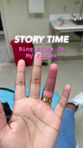 Image result for Ring Removal