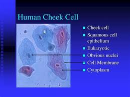 The mitochondrion the cell membrane the cell membrane protects the cell and prevents the cytoplasm it is also one of the largest organelles next to the nucleus and endoplasmic reticulum. Cheek Cell High Power Shefalitayal