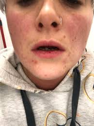 People in recovery at music festivals?