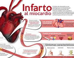 ¿qué es el infarto de miocardio? Pin En Medica