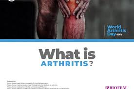 Can Arthritis Come On Suddenly Archives Welcome To Biofemgroup