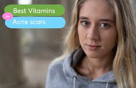 Your skin makes vitamin d when you get sunlight, but many people can't get enough from sun alone. Best Vitamin Supplements For Acne Scars Mdacne