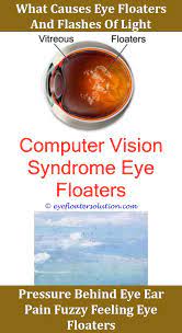 Eye Floaters Meaning In Urdu Eye Floaters Causes Floaters Eye What Causes Eye Floaters