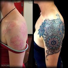 Daniel man, m.d., a florida plastic surgeon, performs tattoo removal on people living in boca raton, fl and the surrounding. Coen Mitchell Tattoogold On Instagram Cover Up Piece Ive Been Working On This Lady Had 6 Laser Removal Sessions On An Old Old Tattoos Tattoo Removal Tattoos
