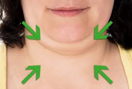 This video shows you how to say jowl.join tsu and get paid for using social media! Tips And Remedies To Reduce Jowls Step To Health