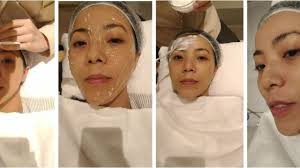 時光停留DNA@geneoo基因表現療程| gratus AI 醫美平台