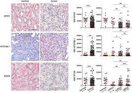 Offering the latest lowering kits for all the newest models. Ihc Staining Of Atgs And Their Quantification Left Panel Download Scientific Diagram