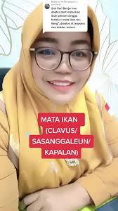 Obat Buat Mata Ikanan