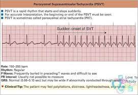 Fortunately, psvt starts in the upper part of the heart (the atria), and is not deadly on its own. Facebook