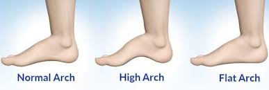 Can You Join The Military With Flat Feet Yes But There S A Catch 2020