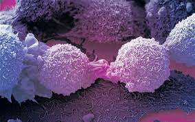 The most common type of cancer on the list is breast cancer, with 284,200 new cases expected in the united states in 2021. Mangalore Today Latest Headlines Of Mangalore Udupi Page Immune Cell Which Kills Most Cancers Discovered Accidently By British Scientists