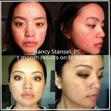 Ivori's path was never an easy one. Many people start from difficult  places, but remember to stay confident and believe in your own strength.**  💖💪