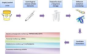 Image result for Expressed Prostatic Secretion