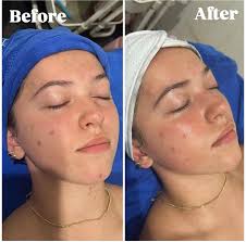 Columbus Cosmetologist and Esthetician Services Available