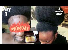 You can encourage the hair to produce hair. Pin On Hair Growth