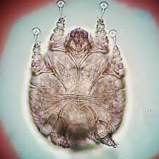 Image result for Sarcoptes scabiei