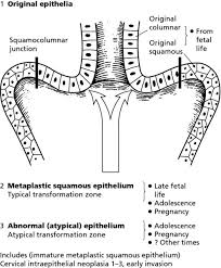 We did not find results for: Colposcopy Of The Normal Cervix A Prerequisite To Establishing The Diagnosis Of Cervical Precancer Obgyn Key
