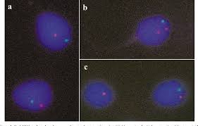 We did not find results for: Pdf Sperm Fish Studies In Seven Male Carriers Of Robertsonian Translocation T 13 14 Q10 Q10 Semantic Scholar