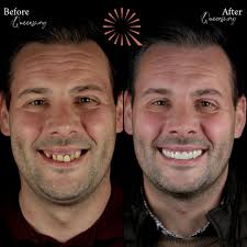 HAPPY 50th BIRTHDAY! Team Queensway want to wish oral surgery  extraordinaire, Dr Matt Dorman a very happy half a century! 🎉 Thank you  for spending your special day with us! 😂