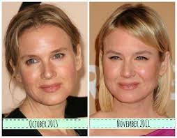 Renee Zellweger Plastic Surgery Mixture Of Skill And Technology Renee Zellweger Plastic Surgery Renee
