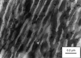 Ask anything you want to learn about nilay savașkan by getting answers on askfm. Evolution Of As Cast And Heat Treated Microstructure Of A Commercial Bearing Alloy Sciencedirect