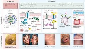 antibiotic allergy the lancet