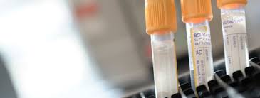 Medsupply international is a leading provider of medical supplies. Raj Talks To The Mail About A Urine Test That Can Help Doctors Spot Signs Of Prostate Cancer South West Andrology