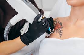 So this was its first quarterly earnings report as a publicly traded. Best Laser Tattoo Removal Services What Should You Know Seo