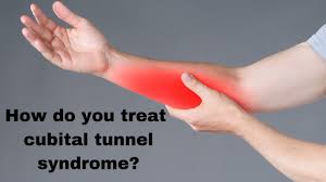 Cubital Tunnel Syndrome London Shoulder Surgeon London Elbow Surgeon