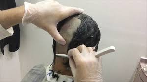 تعلم حلاقة شعر الرأس بالموس بأسهل طريقة Shave Head Hair With Mousse In The Easiest Way Youtube