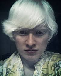 Utra white hair and skin! Meet The Family With 4 Albino Children Including A Blind Daughter Who S A Successful Photographer Daily Mail Online