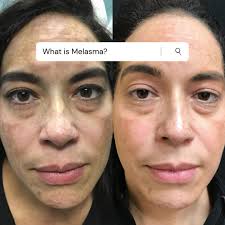 Get quotes & book instantly. Reflections The Center For Cosmetic Medicine Home Facebook