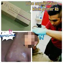 Klinik primer wakaf bharu lot 2569 d, bulatan wakaf bharu jalan palekbang, wakaf baru 16250 kelantan darul naim nama no. Klinik Primer Kota Bharu Malaysia