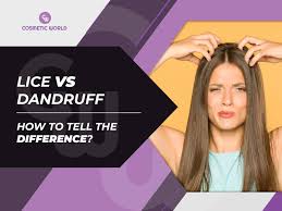 Image result for lice vs dandruff
