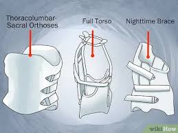 How to get rid of an upward curve. How To Reduce Scoliosis Curvature 10 Steps With Pictures