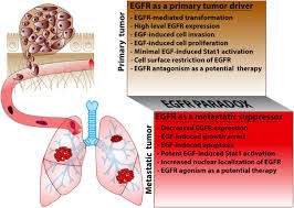 Image result for Primary Tumor Localization