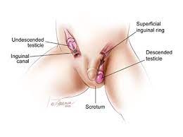 These nodules or masses are usually painless. Testicular Cancer Symptoms Diagnosis Treatment Urology Care Foundation
