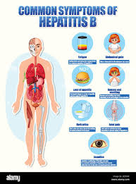 Image result for hepatitis symptoms
