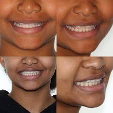 VIVORTHO (@centre.dentaire.vivortho) • Instagram photos and videos