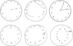 Moca scoring •add up the total points. Clock Drawing Test Springerlink