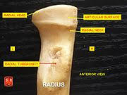 The ulna is usually slightly longer than the radius, but the radius is thicker. Radius Bone Wikipedia