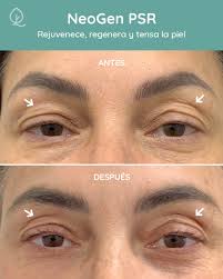 Join Shaun Spanos MSN, APRN, NP & Jeff Spanos from the 5X award-winning  Shaun Charles MedSpa as they reveal how combining NeoGen PSR and CellSound  Aesthetics is revolutionizing non-surgical skin and body