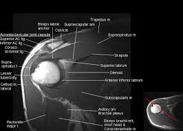 Image result for Shoulder MRI
